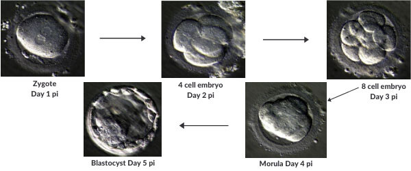Early human embryo development blastocyst
